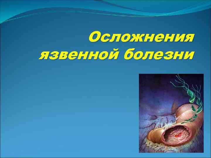 Осложнения язвенной болезни 
