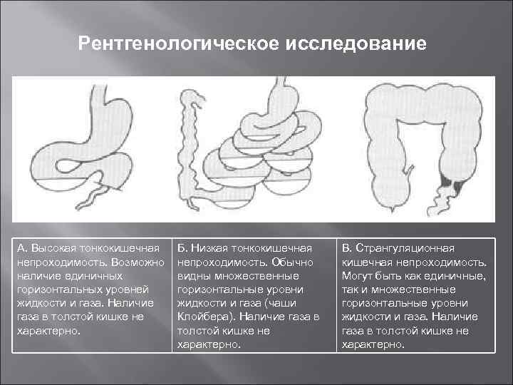 Рентгенологическое исследование А. Высокая тонкокишечная непроходимость. Возможно наличие единичных горизонтальных уровней жидкости и газа.