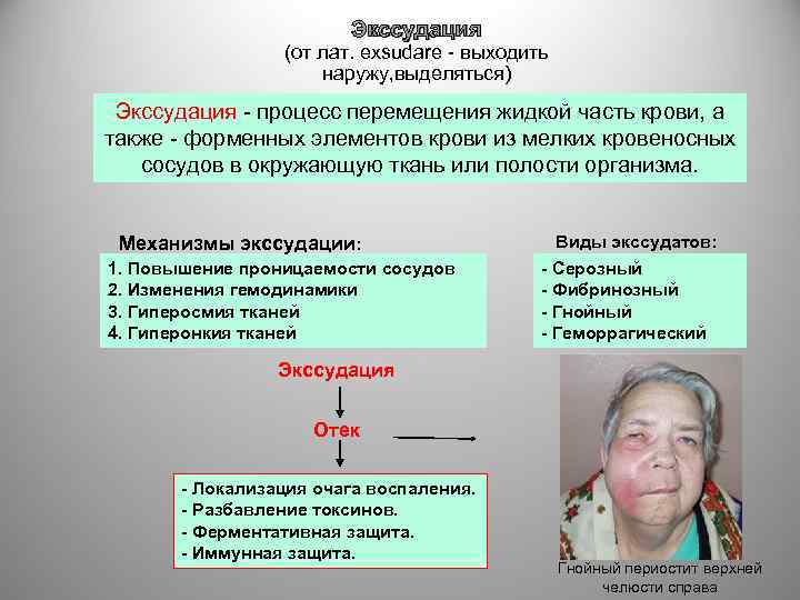 Экссудация (от лат. exsudare - выходить наружу, выделяться) Экссудация - процесс перемещения жидкой часть