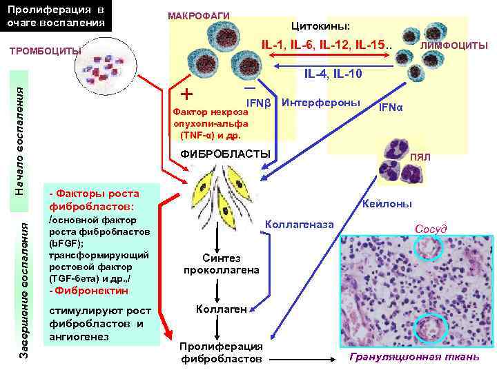 Пролиферация в очаге воспаления МАКРОФАГИ Цитокины: IL-1, IL-6, IL-12, IL-15. . Завершение воспаления Начало