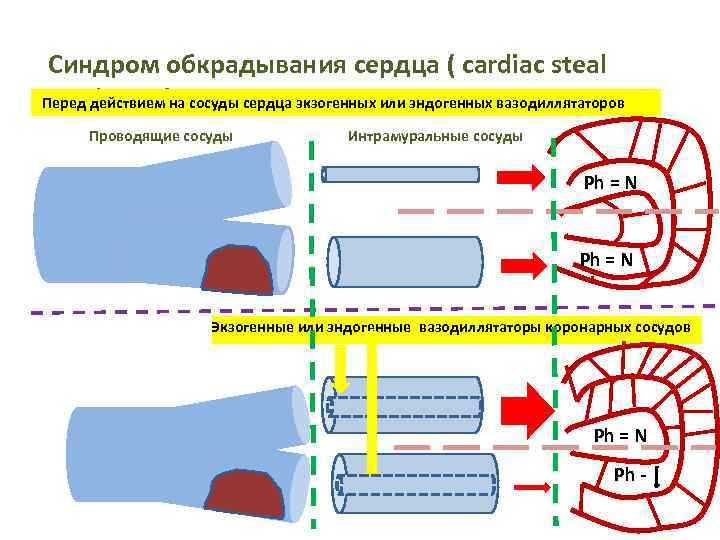 Синдром обкрадывания сердца ( cardiac steal syndrome) Перед действием на сосуды сердца экзогенных или