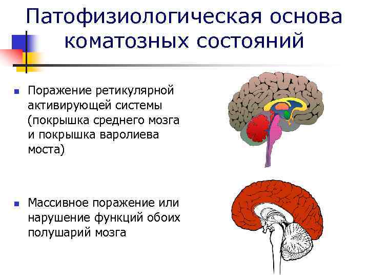 Патофизиологическая основа коматозных состояний n n Поражение ретикулярной активирующей системы (покрышка среднего мозга и