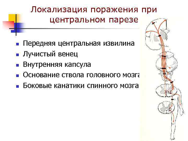 Локализация поражения при центральном парезе n n n Передняя центральная извилина Лучистый венец Внутренняя