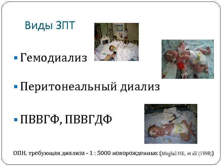 Виды ЗПТ § Гемодиализ § Перитонеальный диализ § ПВВГФ, ПВВГДФ ОПН, требующая диализа -