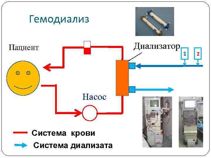 Гемодиализ Диализатор Пациент Насос Система крови Система диализата 1 2 
