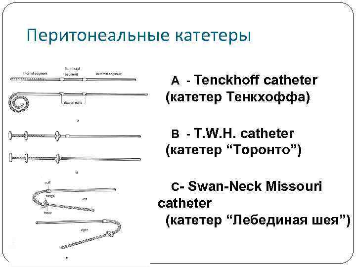 Перитонеальные катетеры A - Tenckhoff catheter (катетер Тенкхоффа) B - T. W. H. catheter