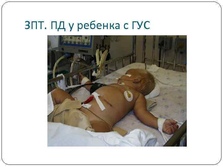 ЗПТ. ПД у ребенка с ГУС 