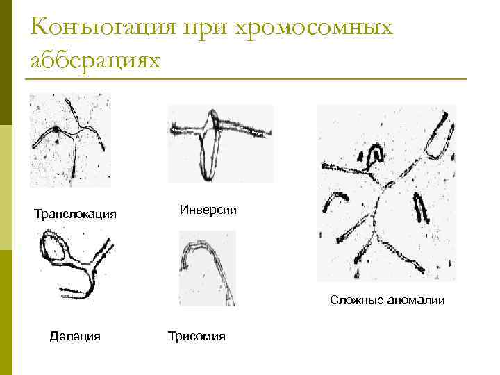 Конъюгация при хромосомных абберациях Транслокация Инверсии Сложные аномалии Делеция Трисомия 