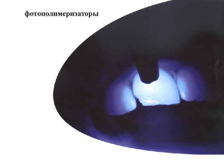 фотополимеризаторы 