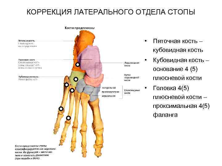 КОРРЕКЦИЯ ЛАТЕРАЛЬНОГО ОТДЕЛА СТОПЫ • Пяточная кость – кубовидная кость • Кубовидная кость –