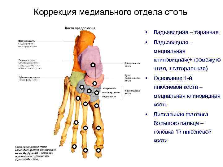 Коррекция медиального отдела стопы • Ладьевидная – таранная • Ладьевидная – медиальная клиновидная(+промежуто чная,