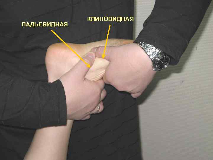 ЛАДЬЕВИДНАЯ КЛИНОВИДНАЯ 