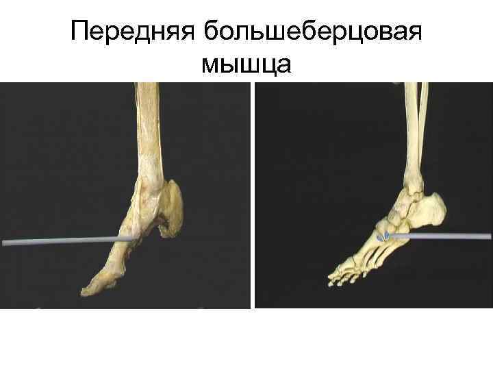 Передняя большеберцовая мышца 
