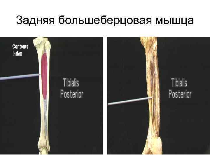 Задняя большеберцовая мышца 