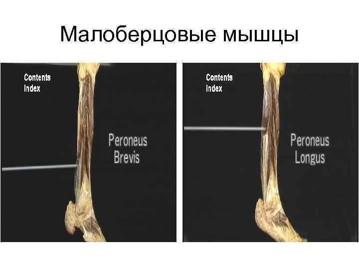 Малоберцовые мышцы 