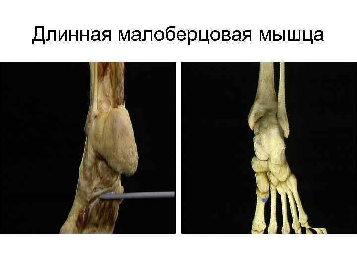 Длинная малоберцовая мышца 