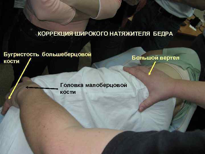 КОРРЕКЦИЯ ШИРОКОГО НАТЯЖИТЕЛЯ БЕДРА Бугристость большеберцовой кости Головка малоберцовой кости Большой вертел 