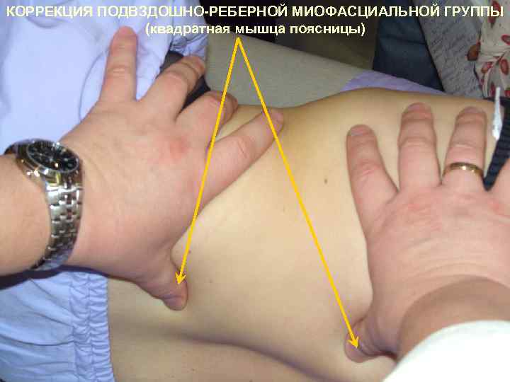 КОРРЕКЦИЯ ПОДВЗДОШНО-РЕБЕРНОЙ МИОФАСЦИАЛЬНОЙ ГРУППЫ (квадратная мышца поясницы) 