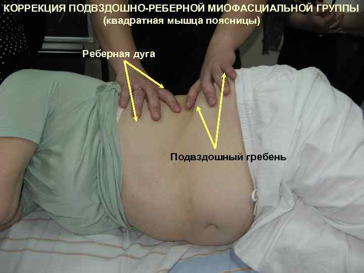 КОРРЕКЦИЯ ПОДВЗДОШНО-РЕБЕРНОЙ МИОФАСЦИАЛЬНОЙ ГРУППЫ (квадратная мышца поясницы) Реберная дуга Подвздошный гребень 