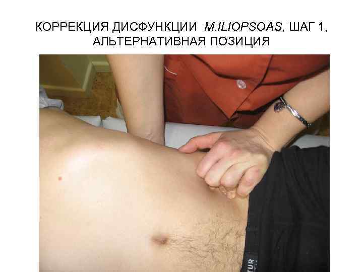 КОРРЕКЦИЯ ДИСФУНКЦИИ M. ILIOPSOAS, ШАГ 1, АЛЬТЕРНАТИВНАЯ ПОЗИЦИЯ 
