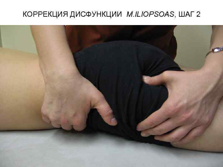 КОРРЕКЦИЯ ДИСФУНКЦИИ M. ILIOPSOAS, ШАГ 2 