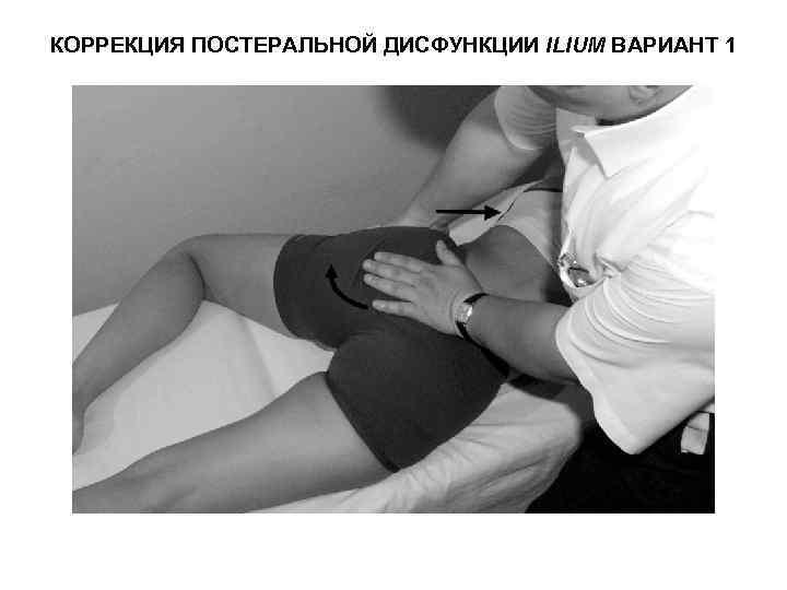 КОРРЕКЦИЯ ПОСТЕРАЛЬНОЙ ДИСФУНКЦИИ ILIUM ВАРИАНТ 1 