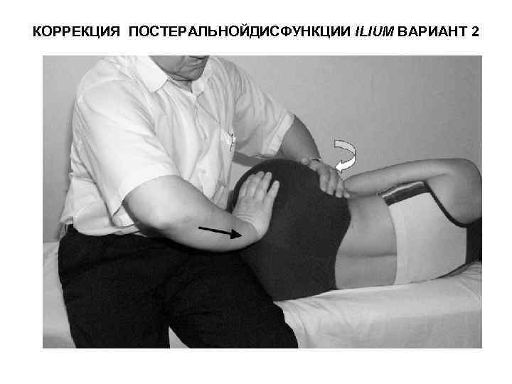 КОРРЕКЦИЯ ПОСТЕРАЛЬНОЙДИСФУНКЦИИ ILIUM ВАРИАНТ 2 