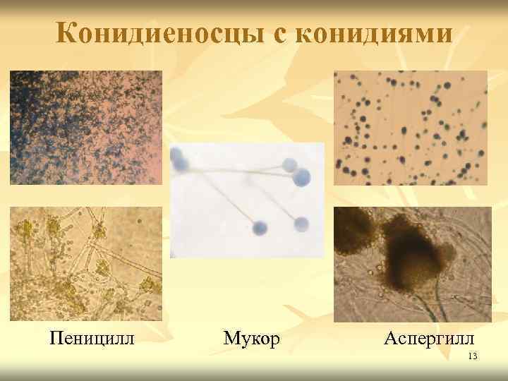 Конидиеносцы с конидиями Пеницилл Мукор Аспергилл 13 