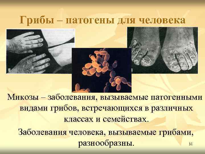 Грибы – патогены для человека Микозы – заболевания, вызываемые патогенными видами грибов, встречающихся в
