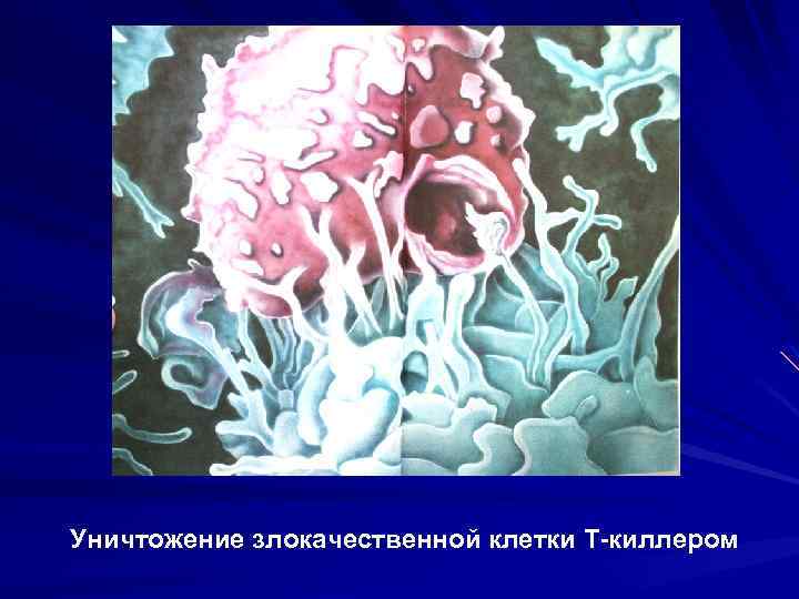 Уничтожение злокачественной клетки Т-киллером 