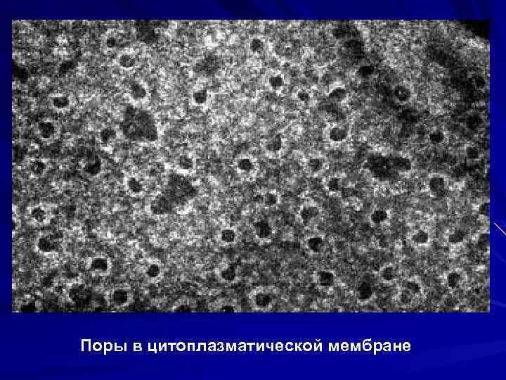 Поры в цитоплазматической мембране 