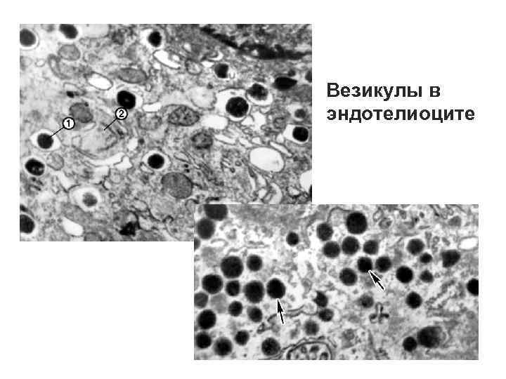 Везикулы в эндотелиоците 