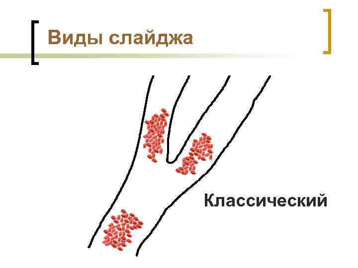 Виды слайджа Классический 