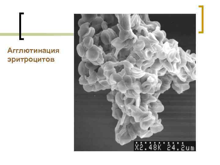 Агглютинация эритроцитов 