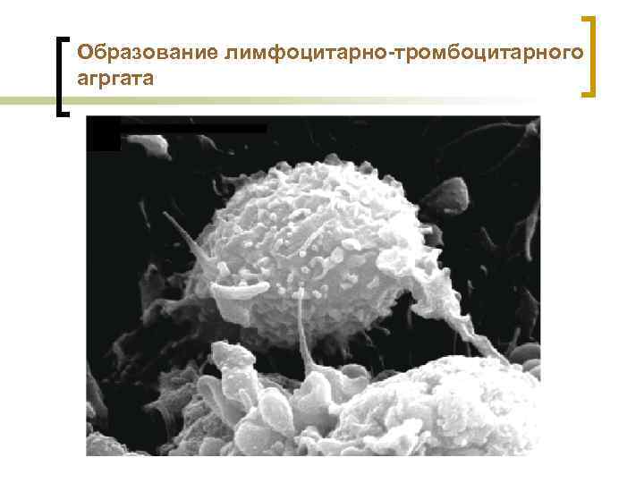 Образование лимфоцитарно-тромбоцитарного агргата 