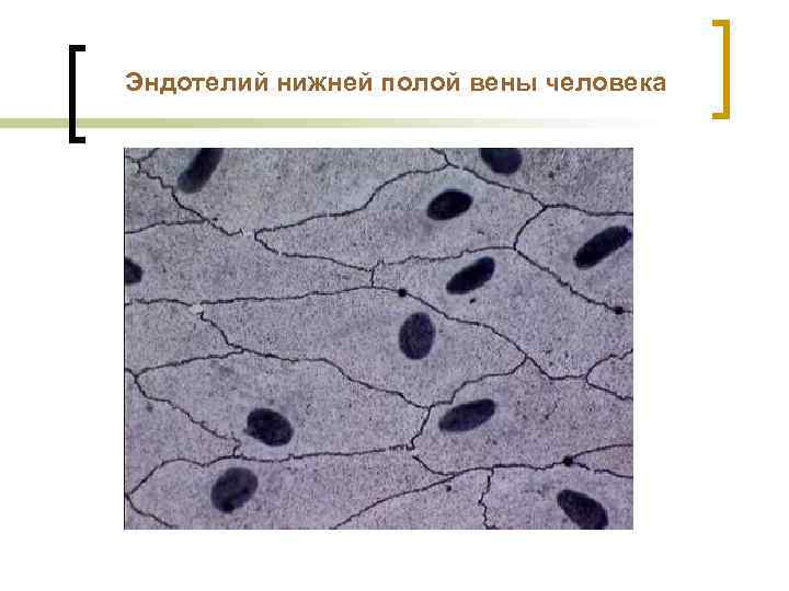 Эндотелий нижней полой вены человека 