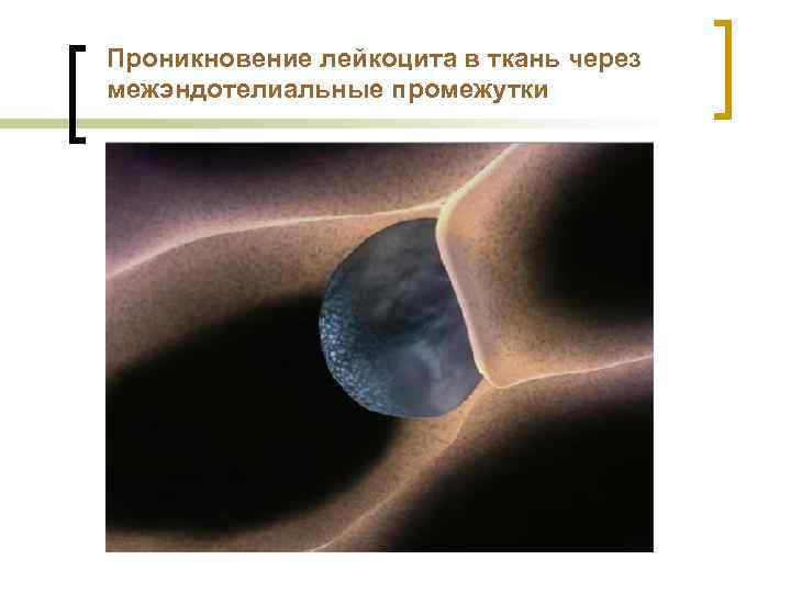 Проникновение лейкоцита в ткань через межэндотелиальные промежутки 