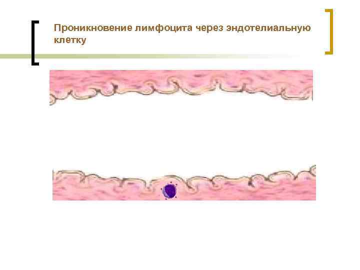 Проникновение лимфоцита через эндотелиальную клетку 