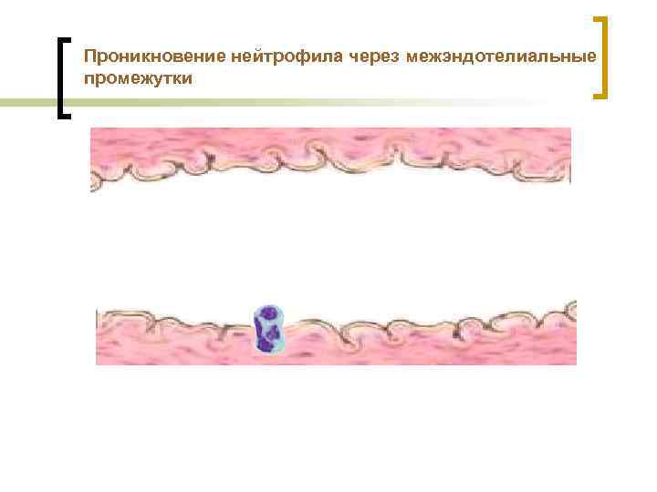 Проникновение нейтрофила через межэндотелиальные промежутки 