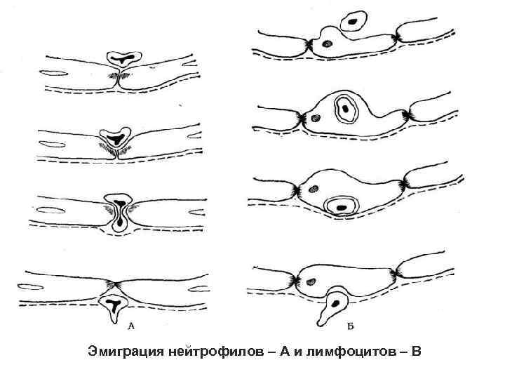 Эмиграция нейтрофилов – А и лимфоцитов – В 