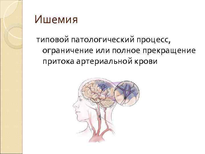 Ишемия типовой патологический процесс, ограничение или полное прекращение притока артериальной крови 