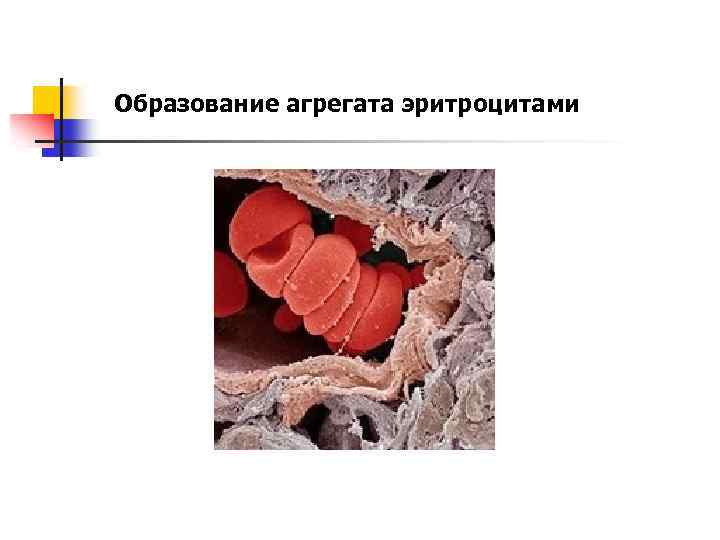 Образование агрегата эритроцитами 