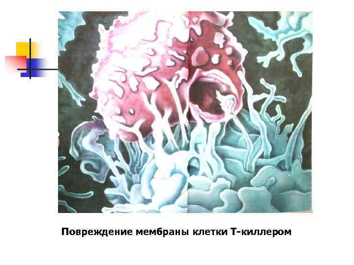 Повреждение мембраны клетки Т-киллером 