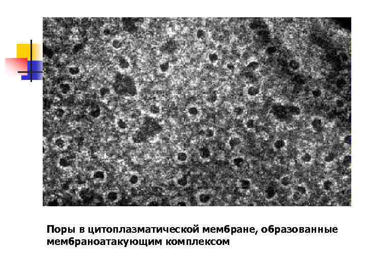 Поры в цитоплазматической мембране, образованные мембраноатакующим комплексом 