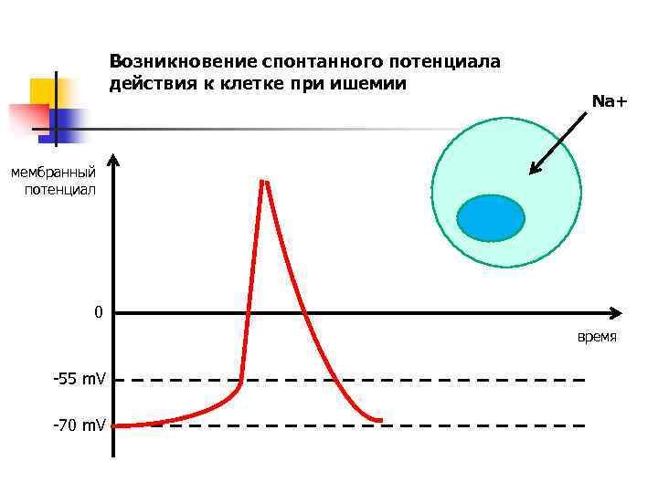 Возникновение спонтанного потенциала действия к клетке при ишемии Na+ мембранный потенциал 0 время -55
