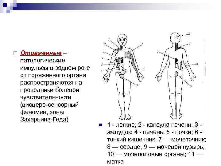 ¨ Отраженные – патологические импульсы в заднем роге от пораженного органа распространяются на проводники