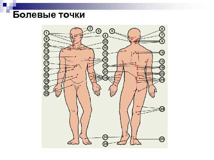 Болевые точки 