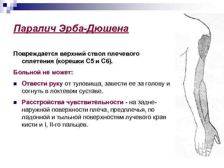 Паралич Эрба-Дюшена Повреждается верхний ствол плечевого сплетения (корешки С 5 и С 6). Больной