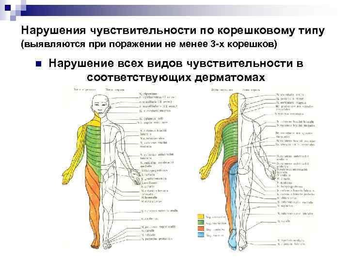 Нарушения чувствительности по корешковому типу (выявляются при поражении не менее 3 -х корешков) n