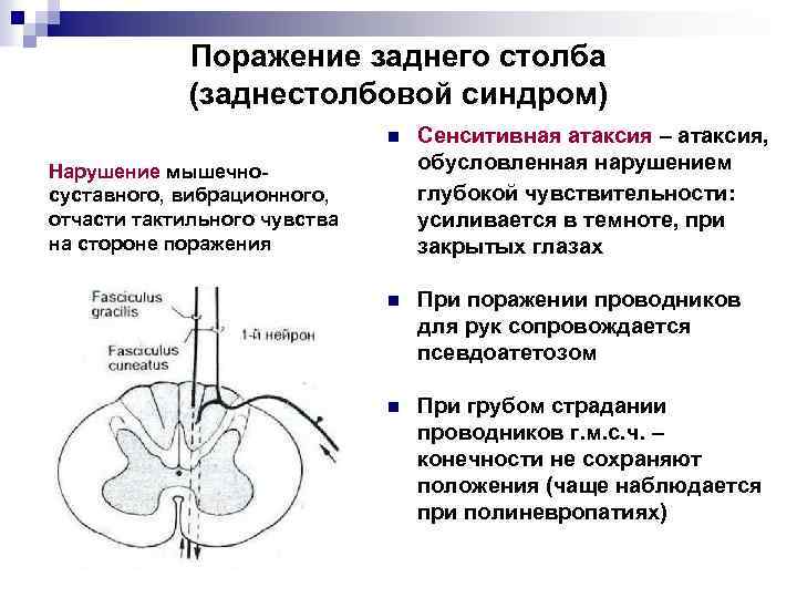 Поражение заднего столба (заднестолбовой синдром) n Сенситивная атаксия – атаксия, обусловленная нарушением глубокой чувствительности: